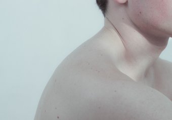 Fotografia "Cecità imposta", fotografo Olga Nekrasova alla Jose Art Gallery